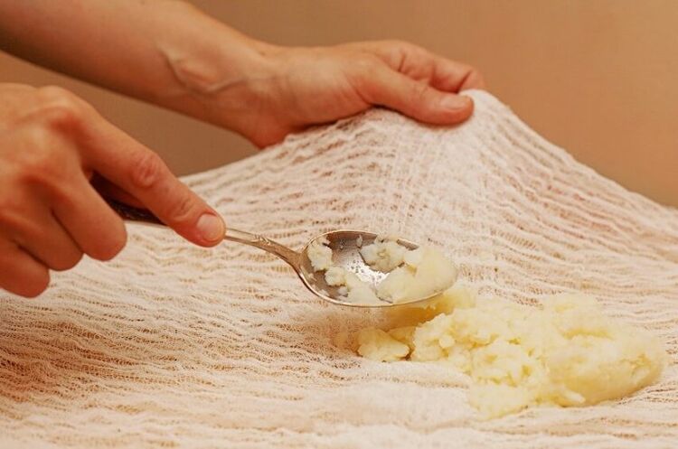 comprimir com batatas para osteocondrose cervical