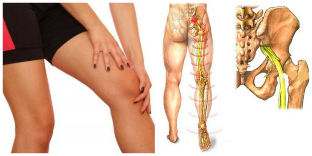 a dor nas costas e pernas tratamento